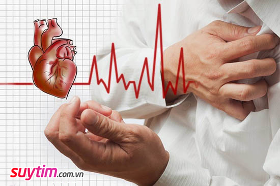 Ngoại tâm thu xuất hiện trên nền các bệnh tim mạch làm tăng nguy cơ đột tử