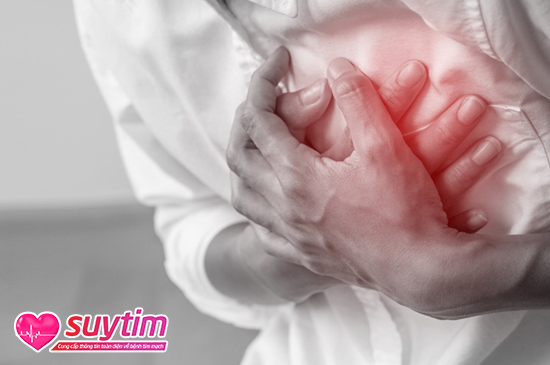 Nhồi máu cơ tim là biến chứng nguy hiểm nhất do xơ vữa mạch vành gây ra