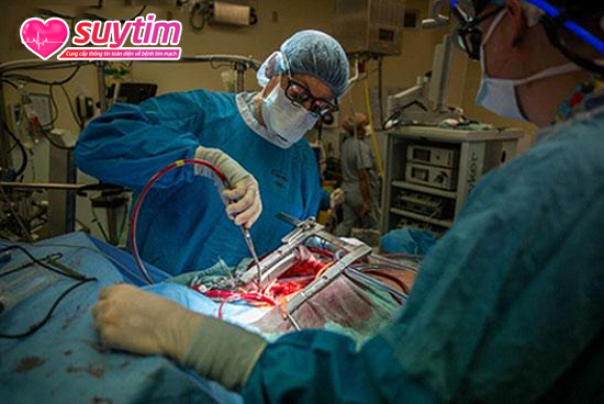 Phẫu thuật là cần thiết nếu tắc hẹp mạch vành nặng và dùng thuốc không hiệu quả.