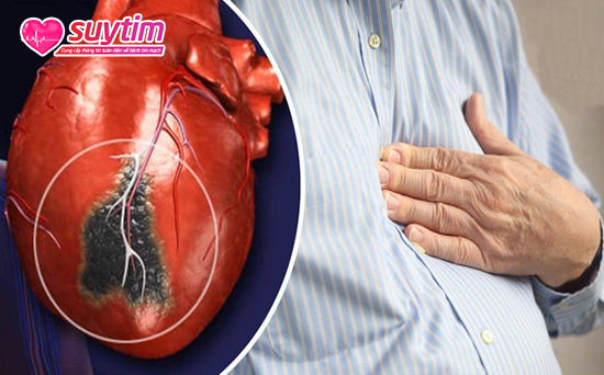 Dihydroquercetin giúp giảm biến chứng do thiếu máu cơ tim gây ra