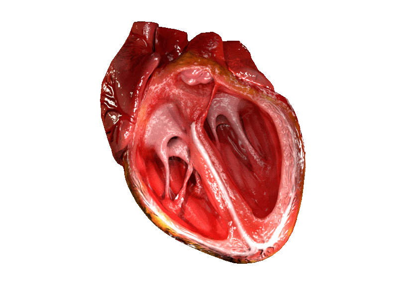 Suy tim tâm thu làm chức năng co bóp của tim giảm