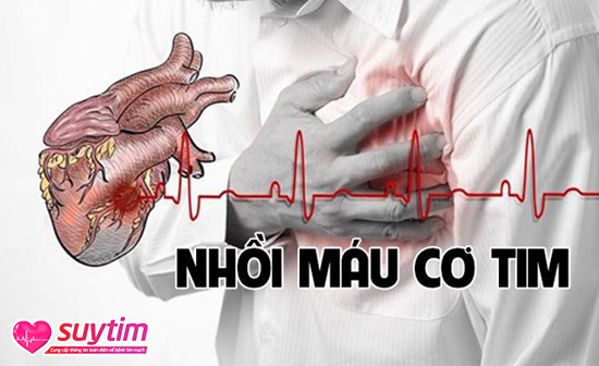 Nhồi máu cơ tim là biến chứng thiếu máu cơ tim có tỷ lệ tử vong cao nhất
