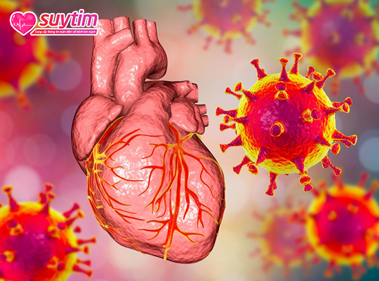 Tổn thương tim mạch có thể xuất hiện trong và sau khi người bệnh nhiễm COVID-19